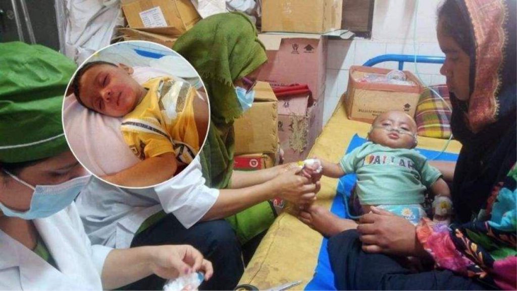 হাম রোগের প্রকোপ: ঢাকার শিশুদের মধ্যে মৃত্যুর ঘটনা বৃদ্ধি