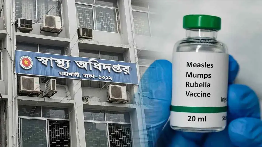 হাম ও হামের উপসর্গে আরও ৬ শিশুর মৃত্যু, ২৪ ঘণ্টায় আক্রান্ত ১৫১৭