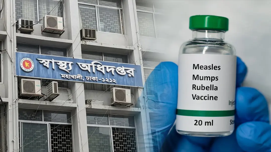 সিলেটে হামের উপসর্গ নিয়ে আরও ৩ শিশুর মৃত্যু, চিকিৎসাধীন ২৮১